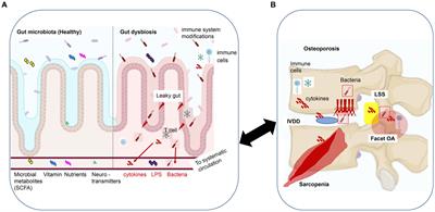 Gut-spine axis: a possible correlation between gut microbiota and spinal degenerative diseases